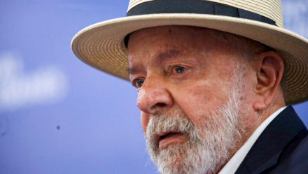 Lula faz primeira sessão de radioterapia após remover lesão na cabeça